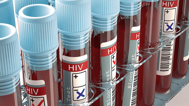 Another HIV Remission Confirms Therapy Option